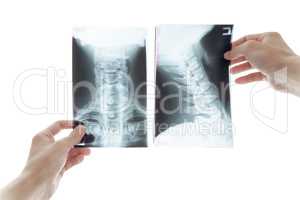 Healthcare, medicine and radiology concept - doctor with stethoscope looking at x-ray