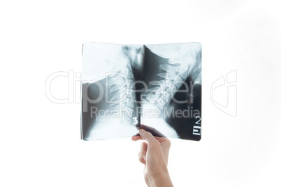 Healthcare, medicine and radiology concept - doctor with stethoscope looking at x-ray