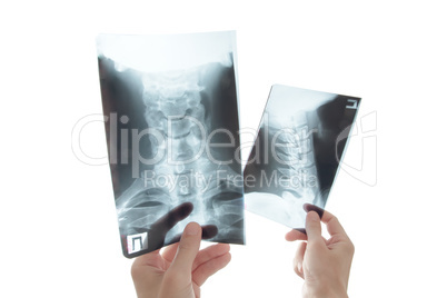 Healthcare, medicine and radiology concept - doctor with stethoscope looking at x-ray