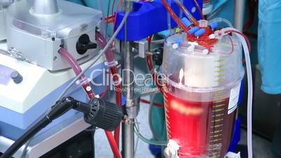 Device for cardiopulmonary bypass pumping blood