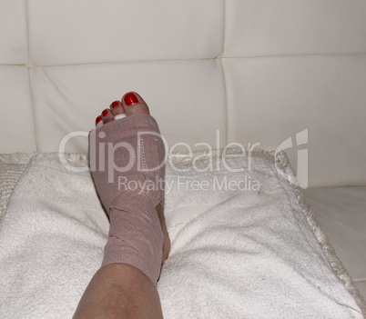 Foot after Morton’s neuroma surgery