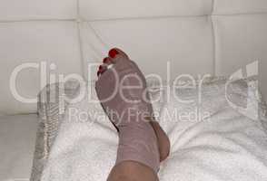 Foot after Morton’s neuroma surgery