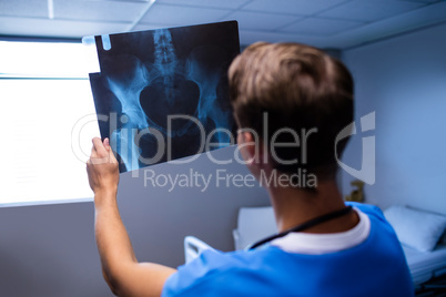 Male doctor examining x-ray report