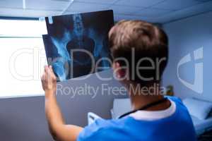 Male doctor examining x-ray report