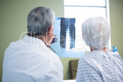 Doctor discussing x-ray report with senior patient