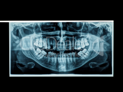 teeth panoramic xray