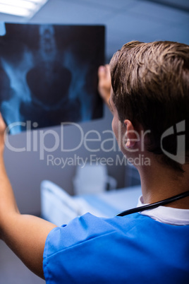 Male doctor examining x-ray report