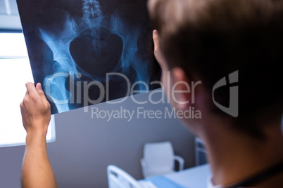 Male doctor examining x-ray report