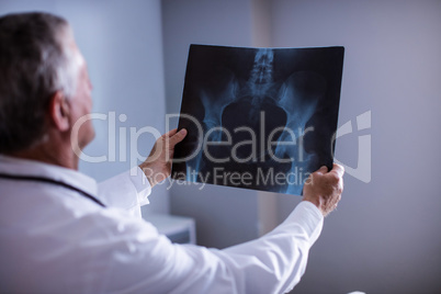 Male doctor examining x-ray report