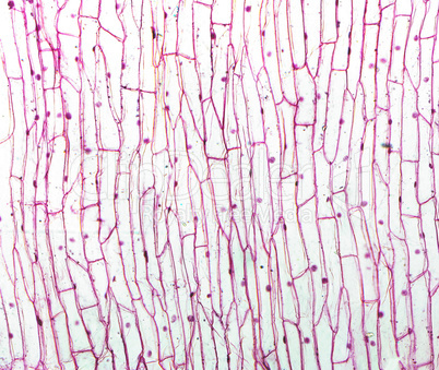 Onion epidermus micrograph