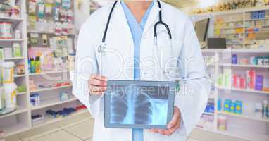 Midsection of doctor showing x-ray on tablet PC in pharmacy