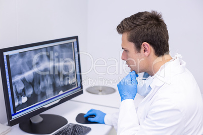 Attentive dentist examining x-ray report on computer