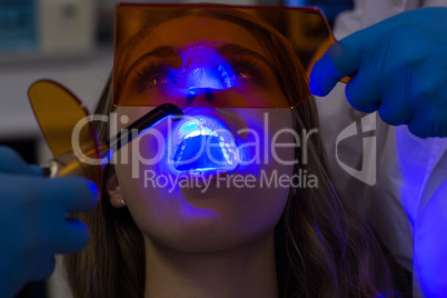 Dentists examining female patient with dental curing light