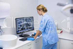 Female nurse examining x-ray report on computer