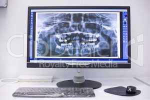 An x-ray on the monitor