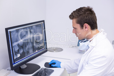 Attentive dentist examining x-ray report on computer