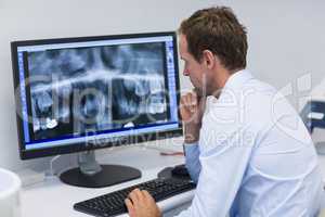 Dentist examining an x-ray on computer in dental clinic