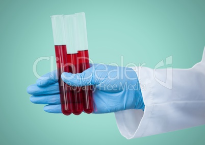 Gloved hand with red tubes against aqua background