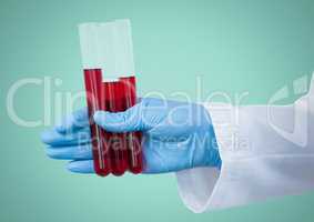 Gloved hand with red tubes against aqua background