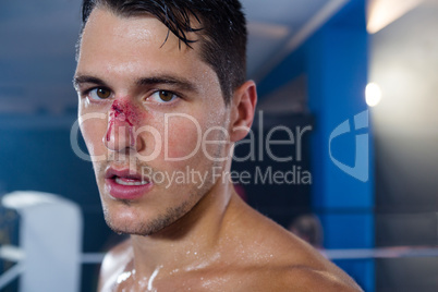 Close-up portrait of young boxer with bleeding nose