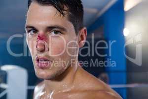 Close-up portrait of young boxer with bleeding nose