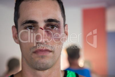 Close-up portrait of male boxer with nose injury