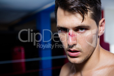 Close-up portrait of young male boxer with bleeding nose
