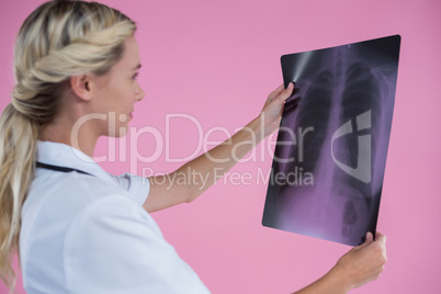 Side view of young female doctor looking at X-ray