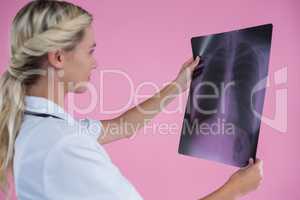 Side view of young female doctor looking at X-ray