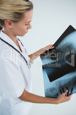 High angle view of female doctor examining X-rays