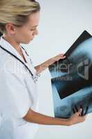 High angle view of female doctor examining X-rays