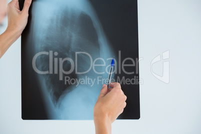 Cropped hand on female doctor examining X-ray