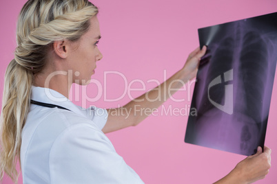 Side view of female doctor looking at X-ray