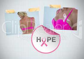 Hope text and Breast Cancer Awareness Photo Collage