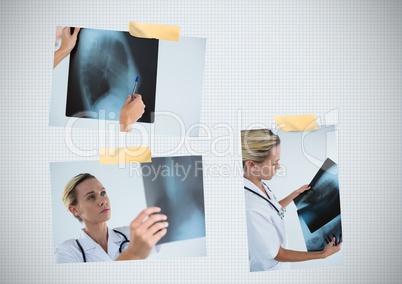 Breast Cancer Awareness Photo Collage with doctor