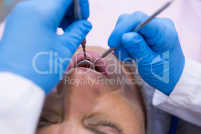 Doctor giving dental treatment to man at clinic