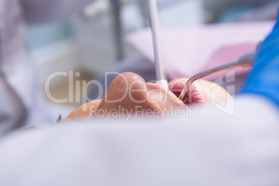 Close up of man receiving dental treatment