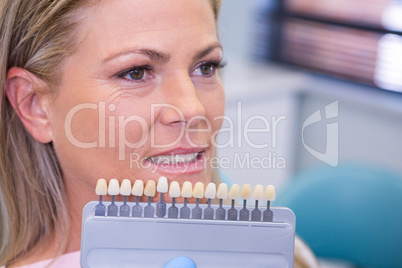 Tooth whitening equipment by smiling patient at medical clinic