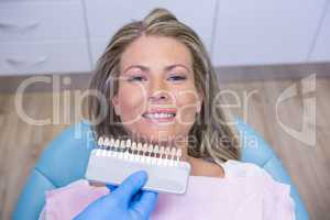 Dentist holding tooth whitening equipment by smiling patient at clinic