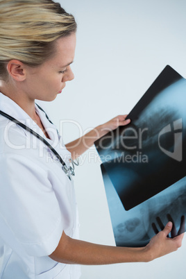 High angle view of doctor examining X-rays