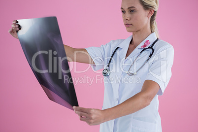 Female doctor looking at X-ray