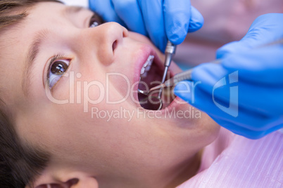 Close up of dentist examining patient