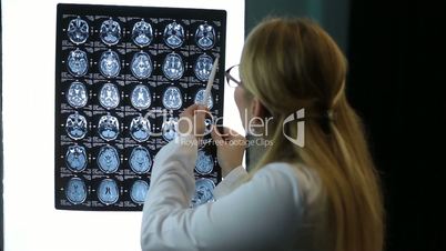 Doctor examines MRI scan of a patient attentively