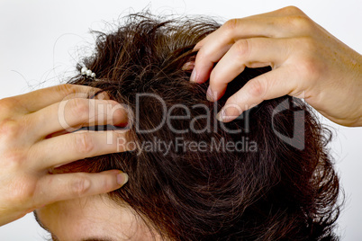 Woman controls head on hair loss