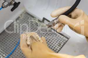 Dental Technician Cleans 3D Printed Dental Implant Bridge