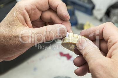 Dental Technician Working On 3D Printed Mold For Tooth Implants