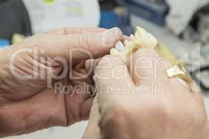 Dental Technician Working On 3D Printed Mold For Tooth Implants