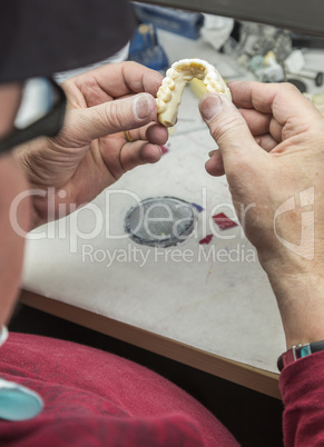 Dental Technician Working On 3D Printed Mold For Tooth Implants