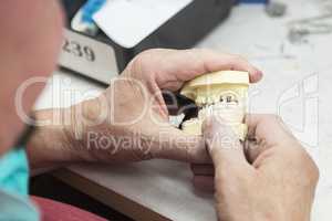 Dental Technician Working On 3D Printed Mold For Tooth Implants