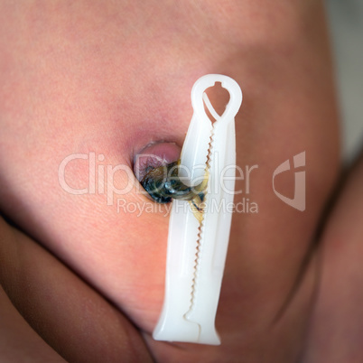 Close up umbilical cord with clamp of newborn